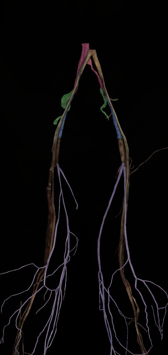 <p>Name the structure highlighted (purple)</p>