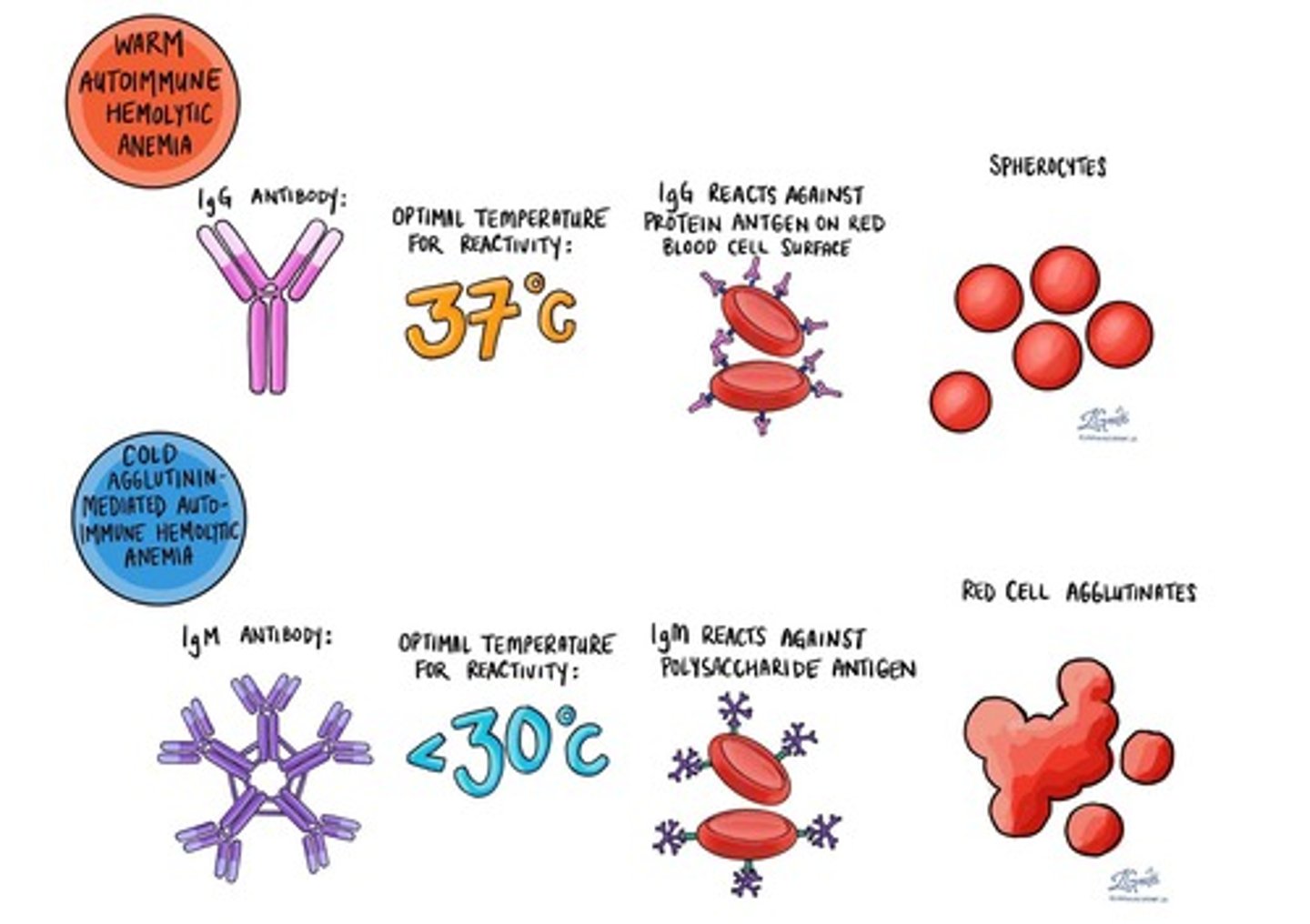 <p>The most common autoimmune hemolytic anemia, where autoantibodies react optimally at 37°C.</p>
