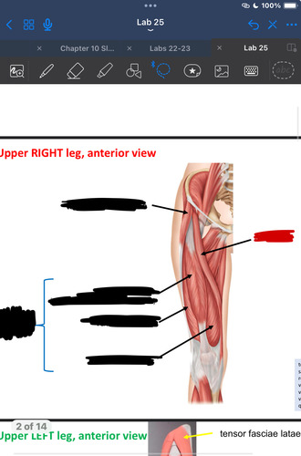 <p>What muscle is this?</p>
