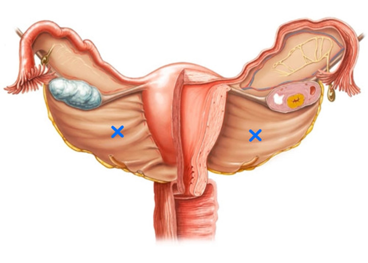 <p>ID Structure marked with the Blue X's</p>