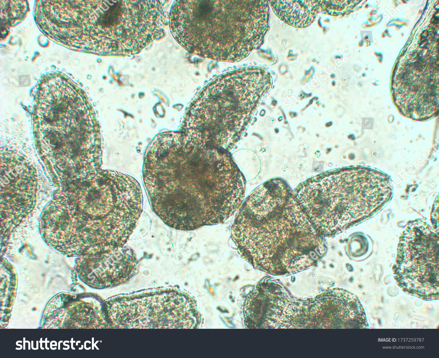 <p><span><span>The </span></span><strong><mark data-color="rgba(0, 0, 0, 0)" style="background-color: rgba(0, 0, 0, 0); color: inherit;">larval stage of </mark><em><mark data-color="rgba(0, 0, 0, 0)" style="background-color: rgba(0, 0, 0, 0); color: inherit;">Echinococcus</mark></em><mark data-color="rgba(0, 0, 0, 0)" style="background-color: rgba(0, 0, 0, 0); color: inherit;"> tapeworms</mark></strong></p>