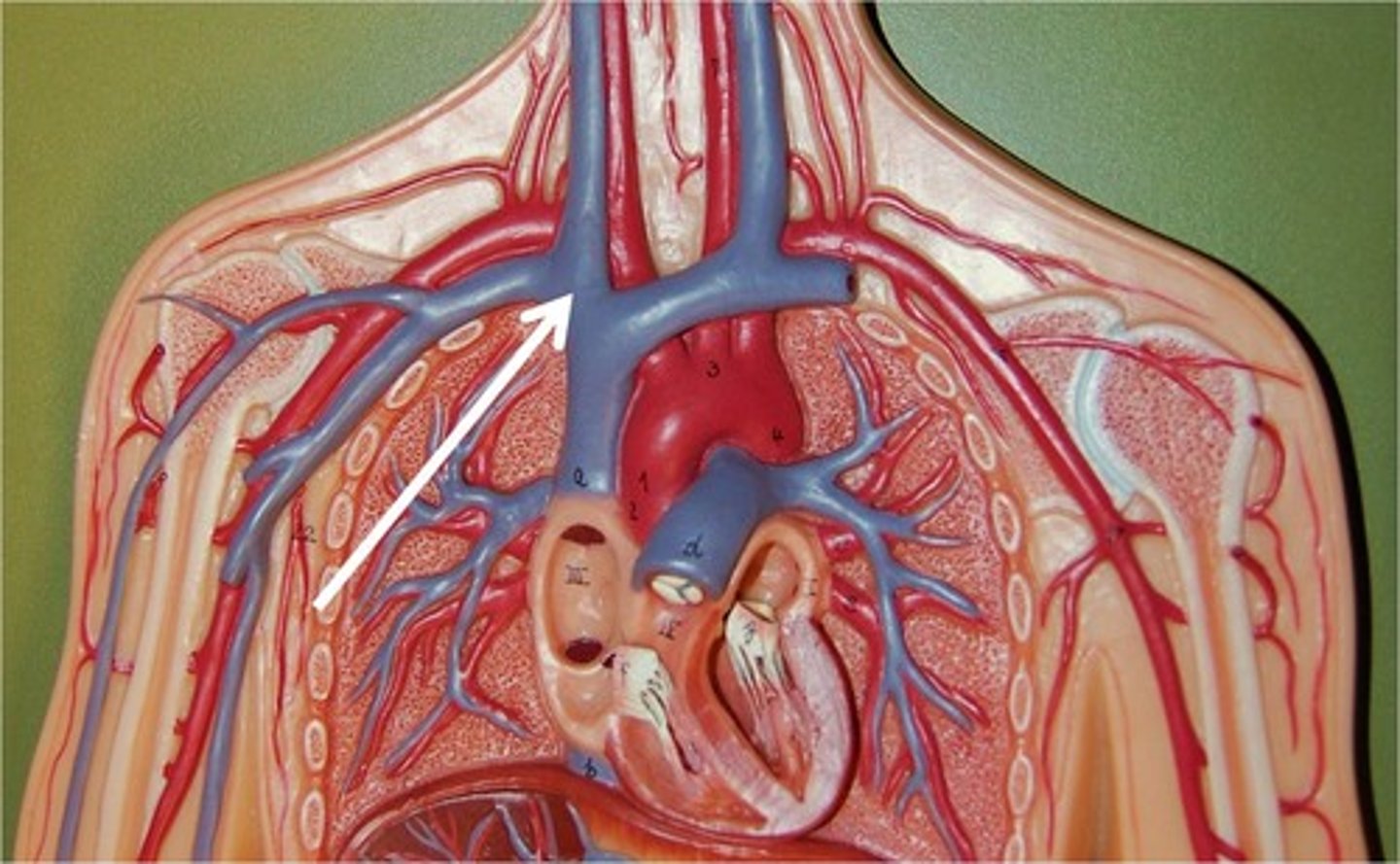 <p>receives from subclavian, drains into superior vena cava</p>