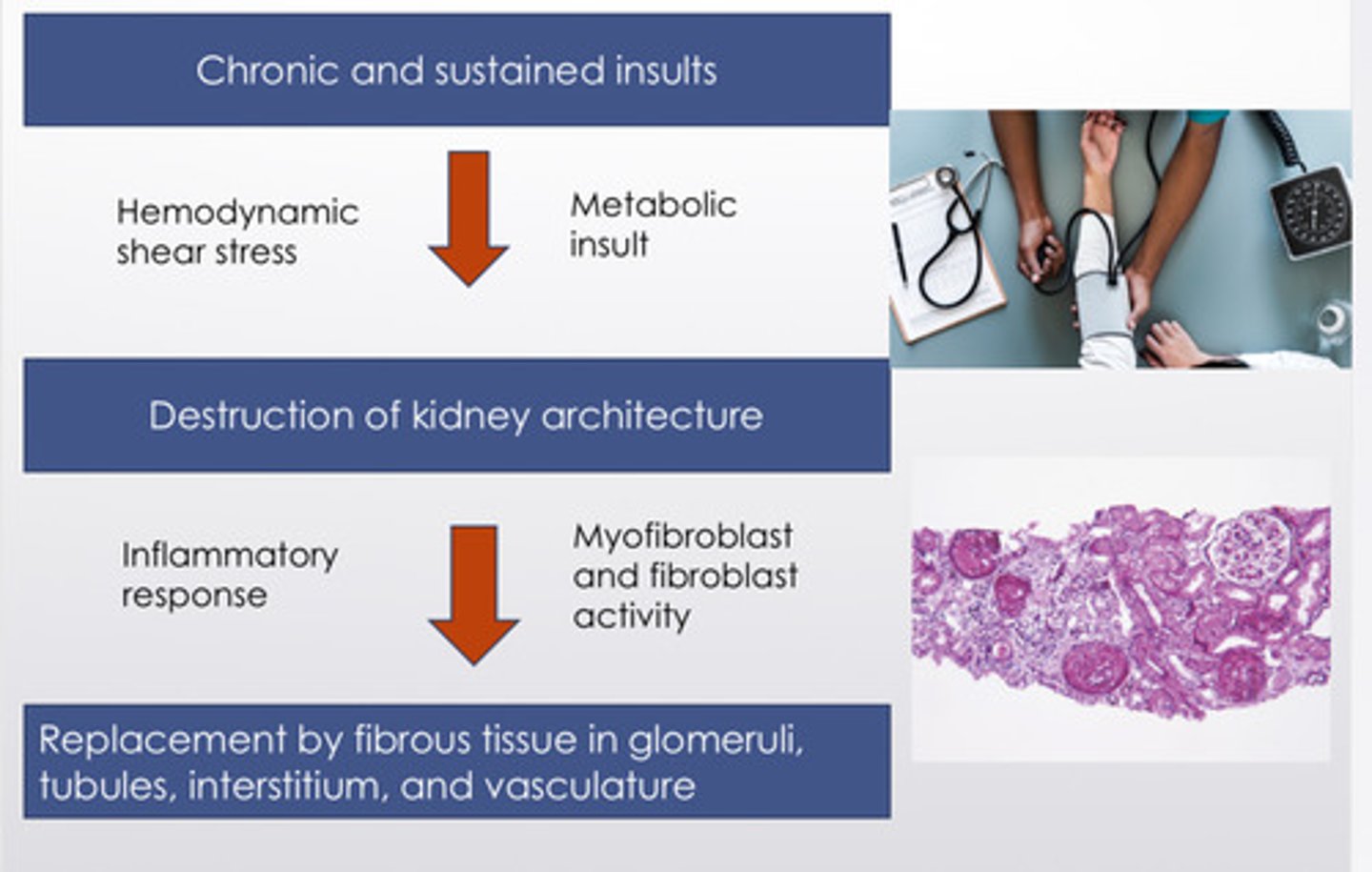 <ol><li><p>chronic and sustained insults (hemodynamic shear stress, metabolic insults) -&gt;</p></li><li><p>destruction of kidney architecture (inflammatory response, myofibroblast and fibroblast activity) -&gt;</p></li><li><p>replacement by fibrous tissue in glomeruli, tubules, interstitium, and vasculature</p></li></ol><p></p>
