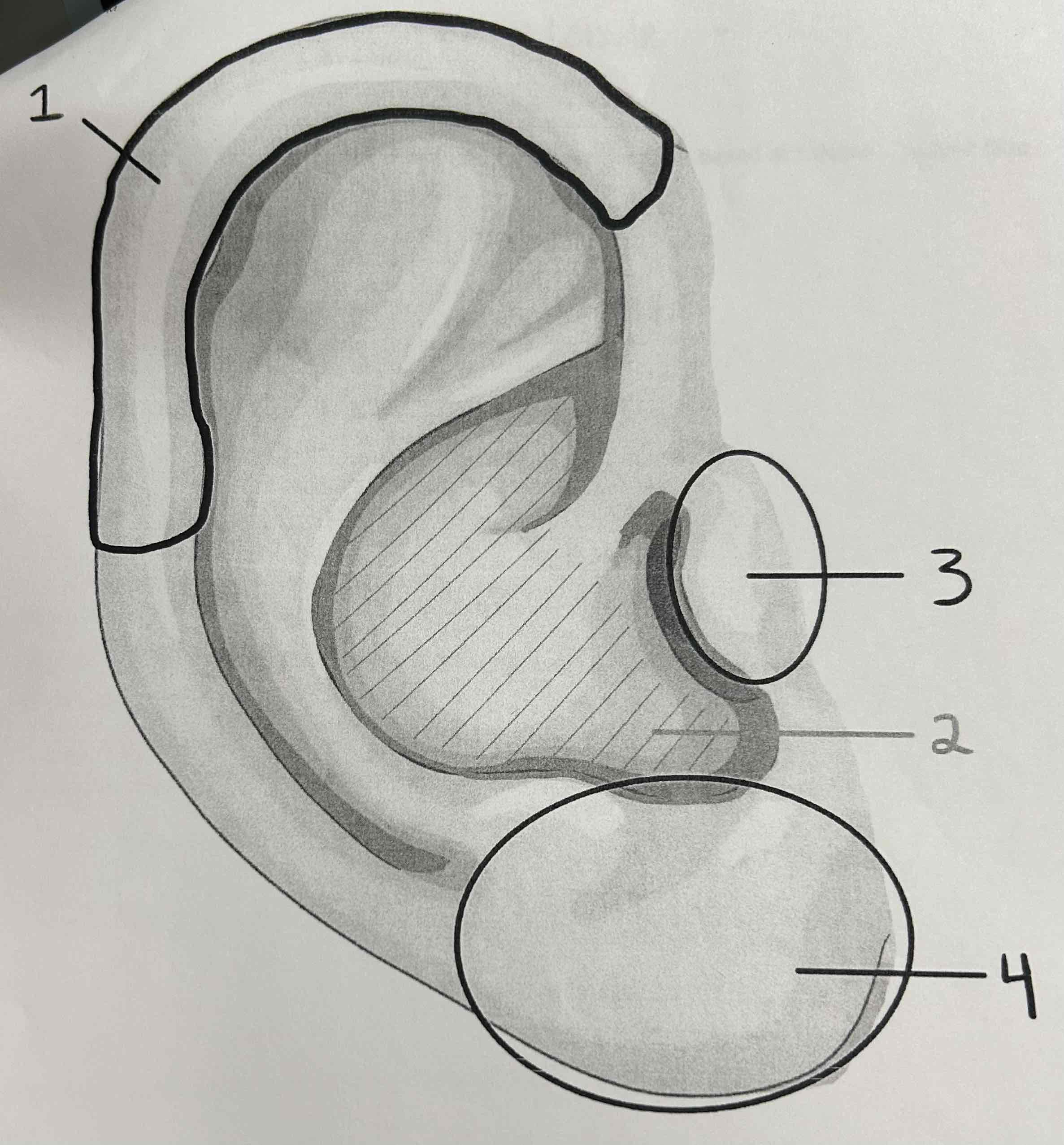 <p>What is number 1 pointing to?</p>