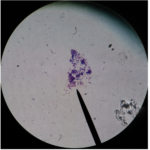 <p>What type of stain is this?</p>