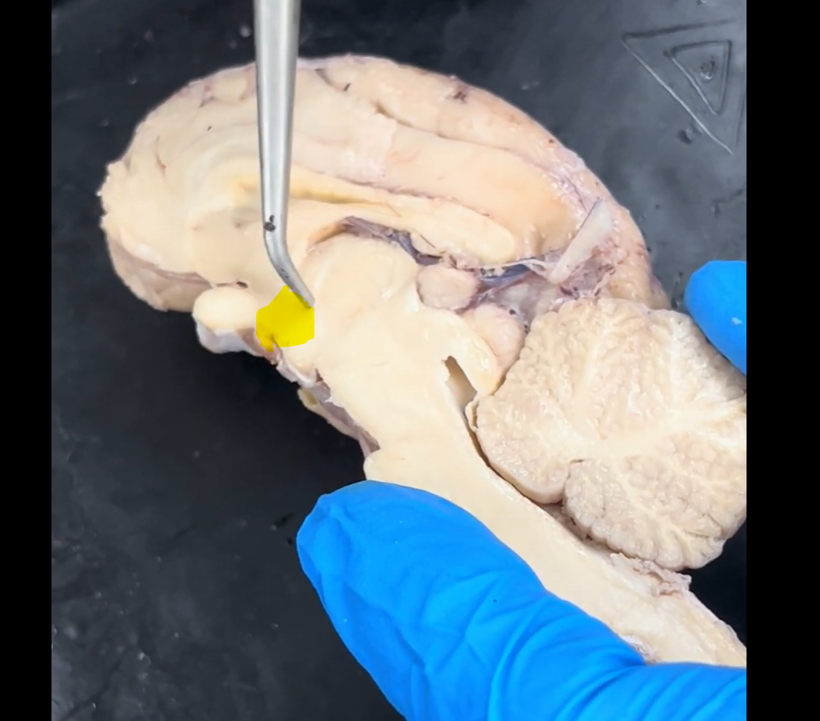 <p>Name the part of the brain that is highlighted in yellow.</p>