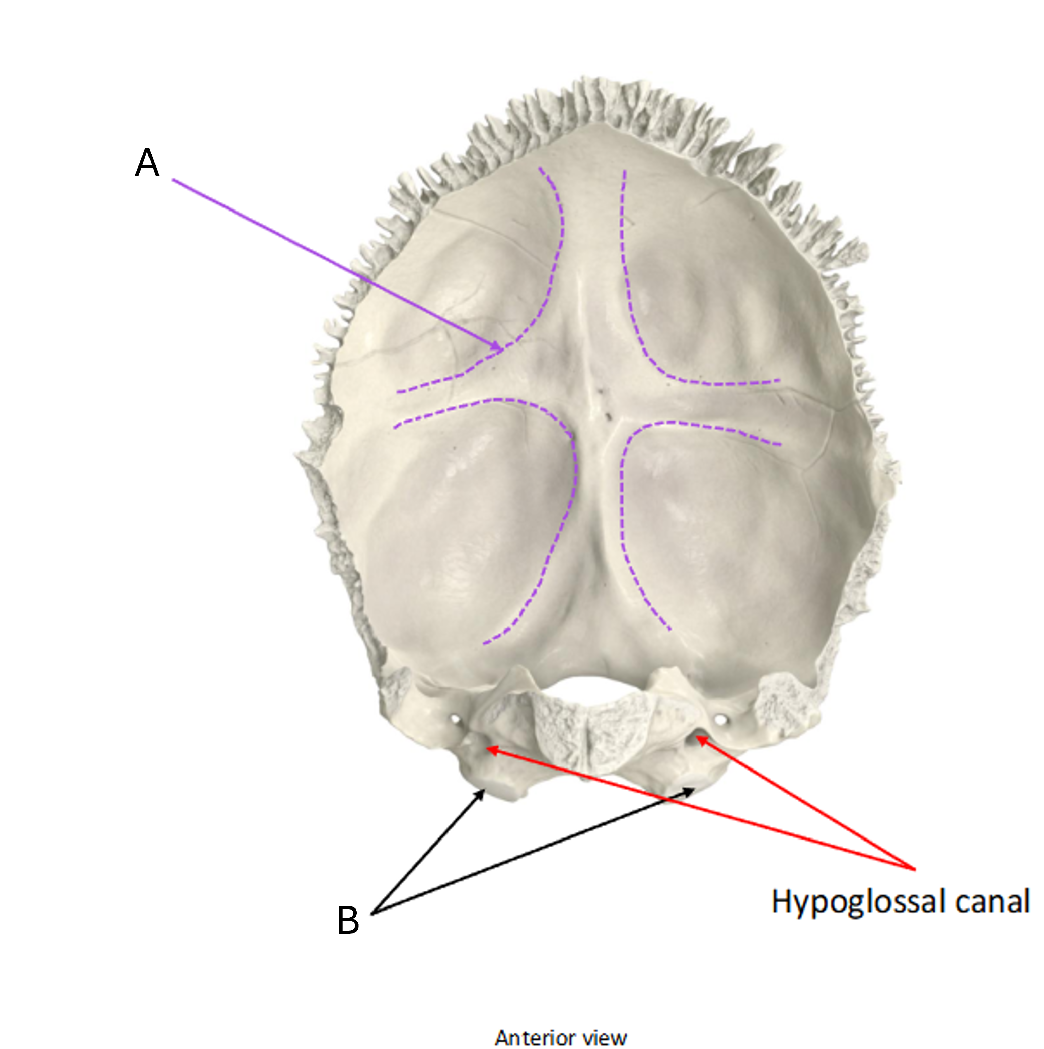 term image