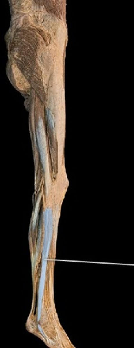 <p>What muscle is this?</p>
