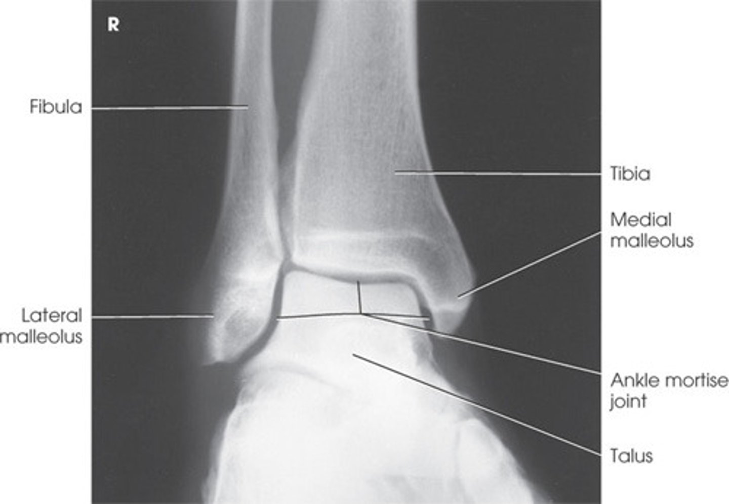 <p>Mortise joint</p>