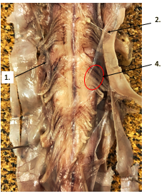 <p>What structure of the spinal cord is #1?</p>