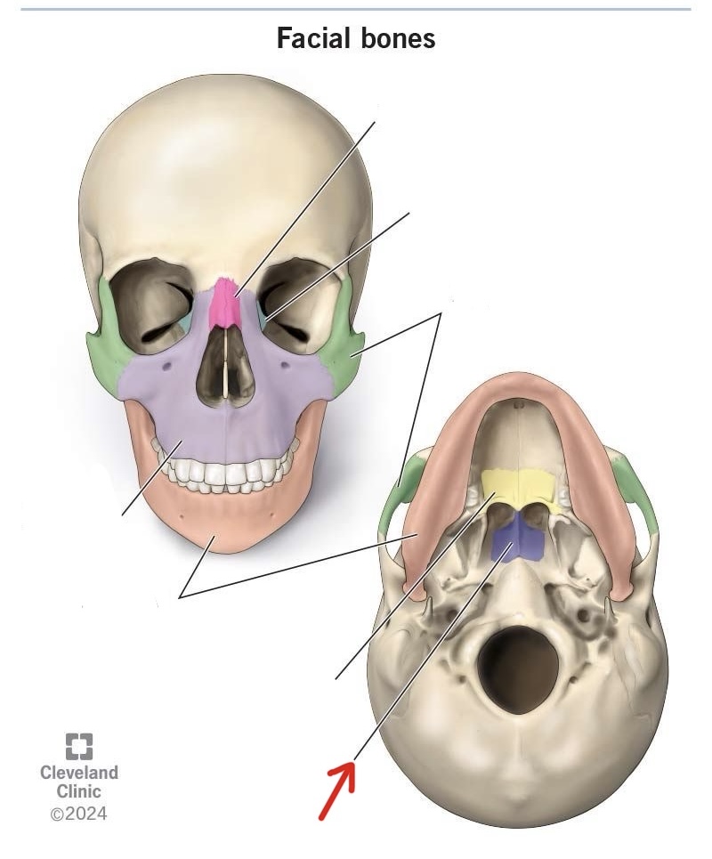 term image