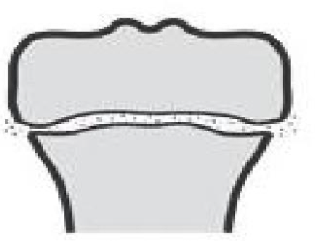 <p>what type of fx is this?</p>