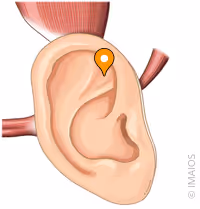 <p>what part of the ear is this</p>
