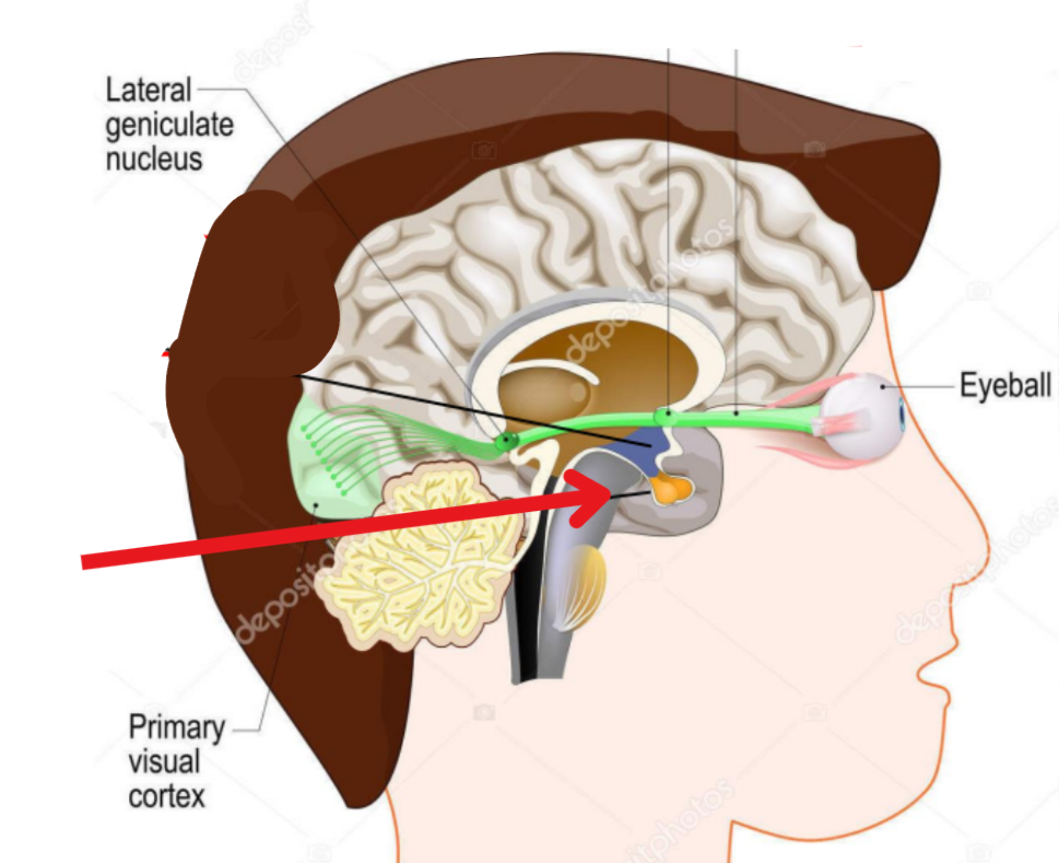 term image