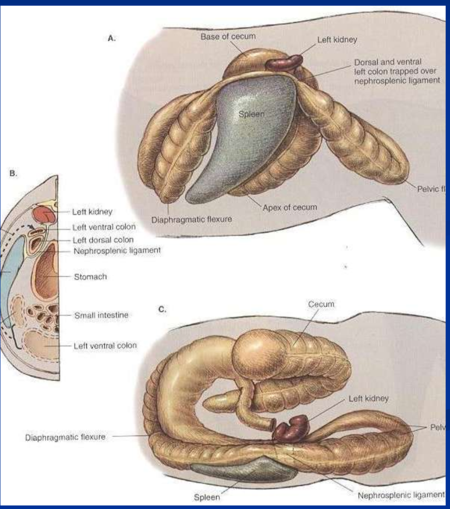 <p>left dorsal displacement of the large colon </p>