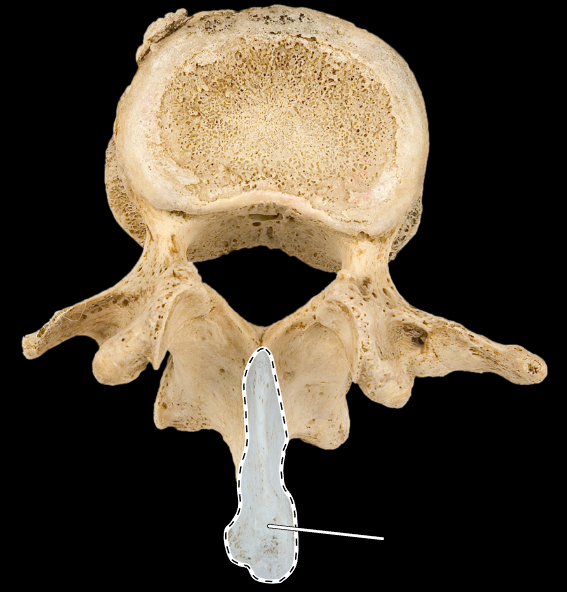 <p>What part of the vertebra is highlighted?</p><p>What type of vertebra is this (which region is this vertebra from)?</p><p>(Superior view).</p>
