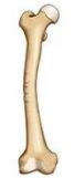 <p>what kind of fracture is this </p>