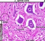 What type of glial cells?