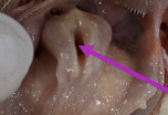 <p>opening into larynx that closes to block food from going into the larynx</p>