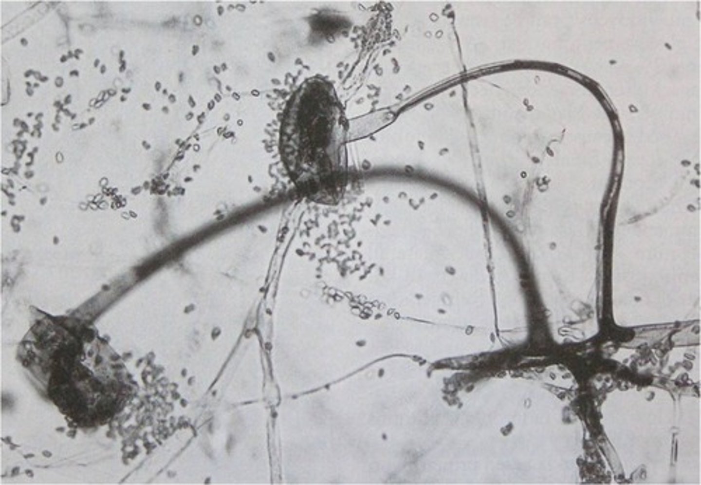 <p>specialized hyphae that look like upright stalks.</p>