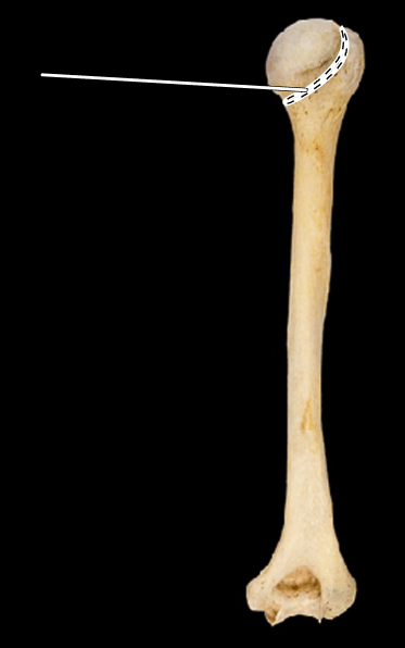 <p>Name the highlighted portion.</p><p>(Humerus, posterior view, right side).</p>