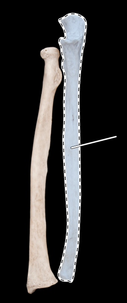 <p>Name this bone.</p><p>(Anterior view).</p>