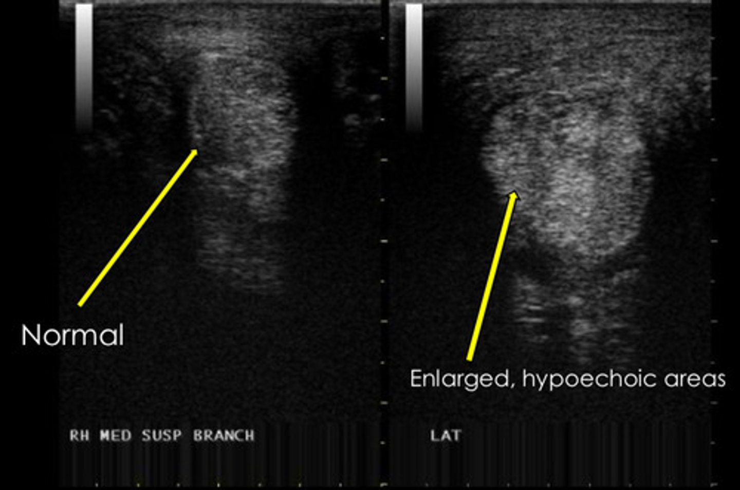 <p>If you are performing ultrasound and are unsure of your findings, what should your next step be?</p>
