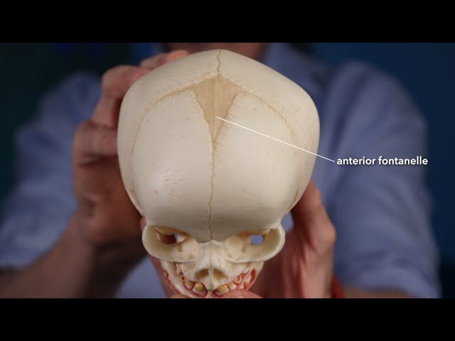 <p>made of fibrous membranes in a fetal skull, located between the two frontal and two parietal bones</p>