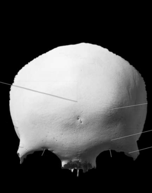 <p>Identify the front superciliary arch</p>