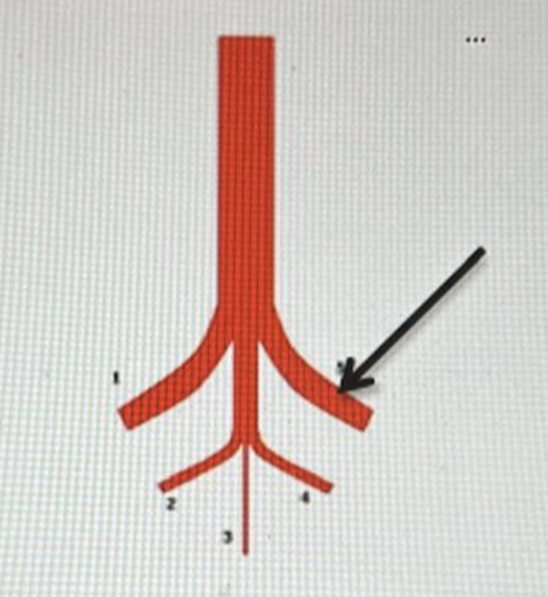 <p>C</p>