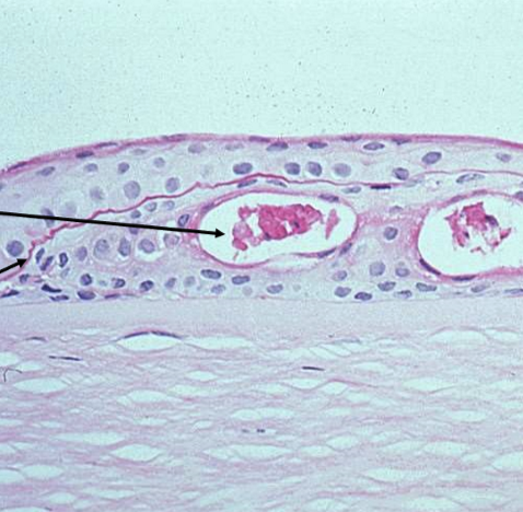 <p>They are below the basement membrane surrounded by epithelial cells. </p>