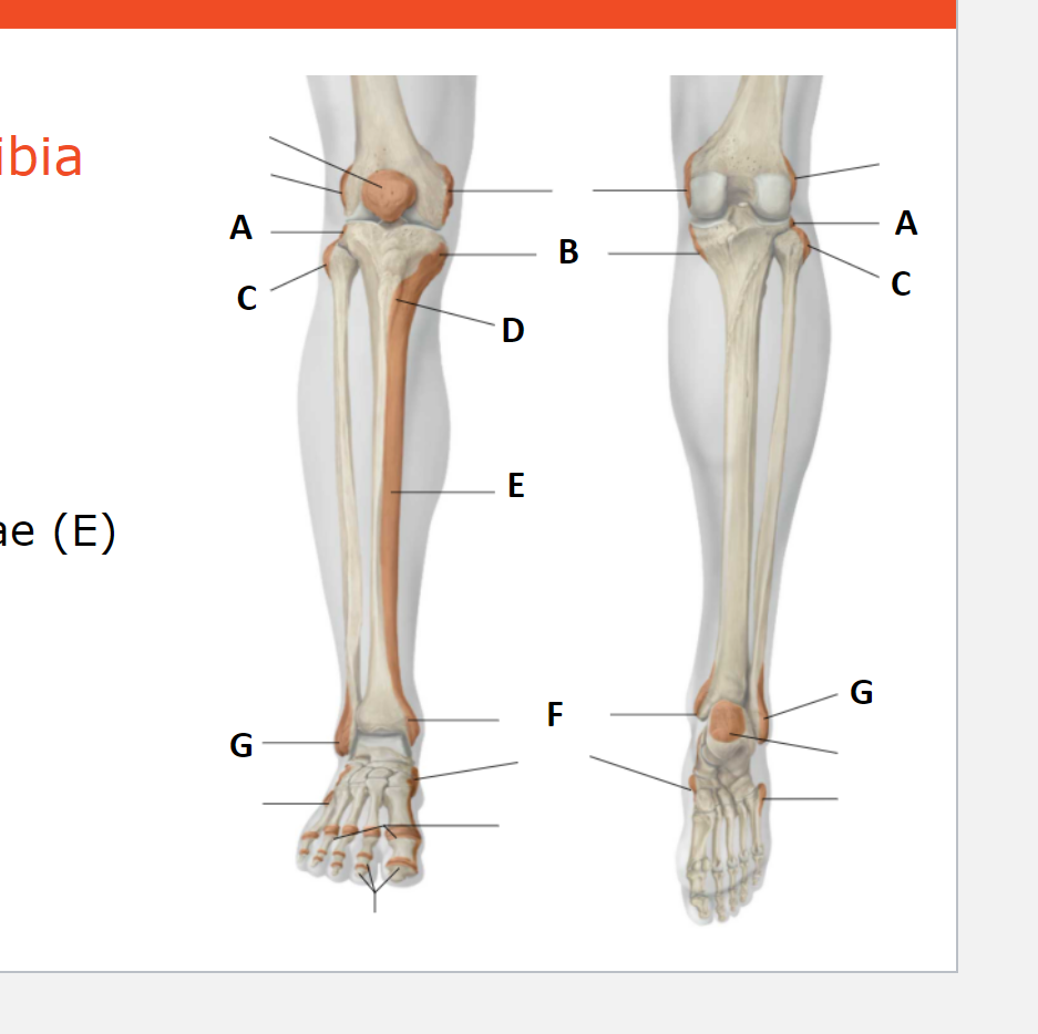 <p>Palpable bony prominences of the tibia and fibula</p>