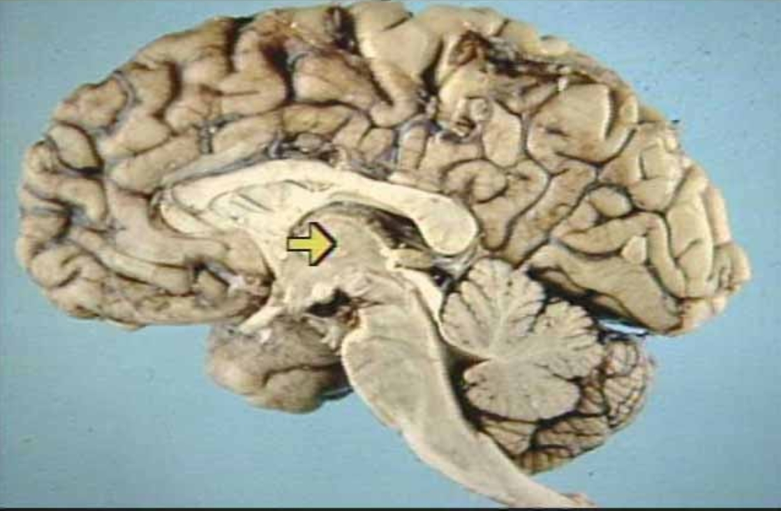 <p>What is the arrow pointing at?</p>