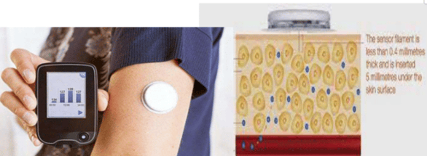 <p>- PRE-each MEAL</p><p>- POST-MEALS (if new dx)</p><p>- at BEDTIME</p><p>(4x per day is minimum requirement, 8 for newly diagnosed patients => pre+post meals; bedtime; nighttime)</p>