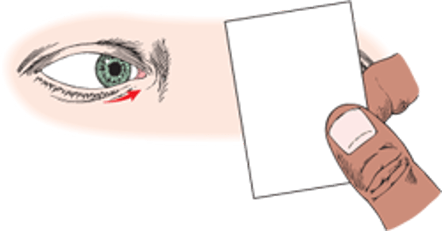 <p>latent tendency for the eyes to misalign, which is only revealed when an eye is covered. Unlike a tropia, which is a constant eye turn, a phoria is a temporary, hidden misalignment that the brain usually corrects to maintain single vision.</p>