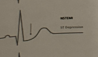 <p>6 months after cardiac injury</p>