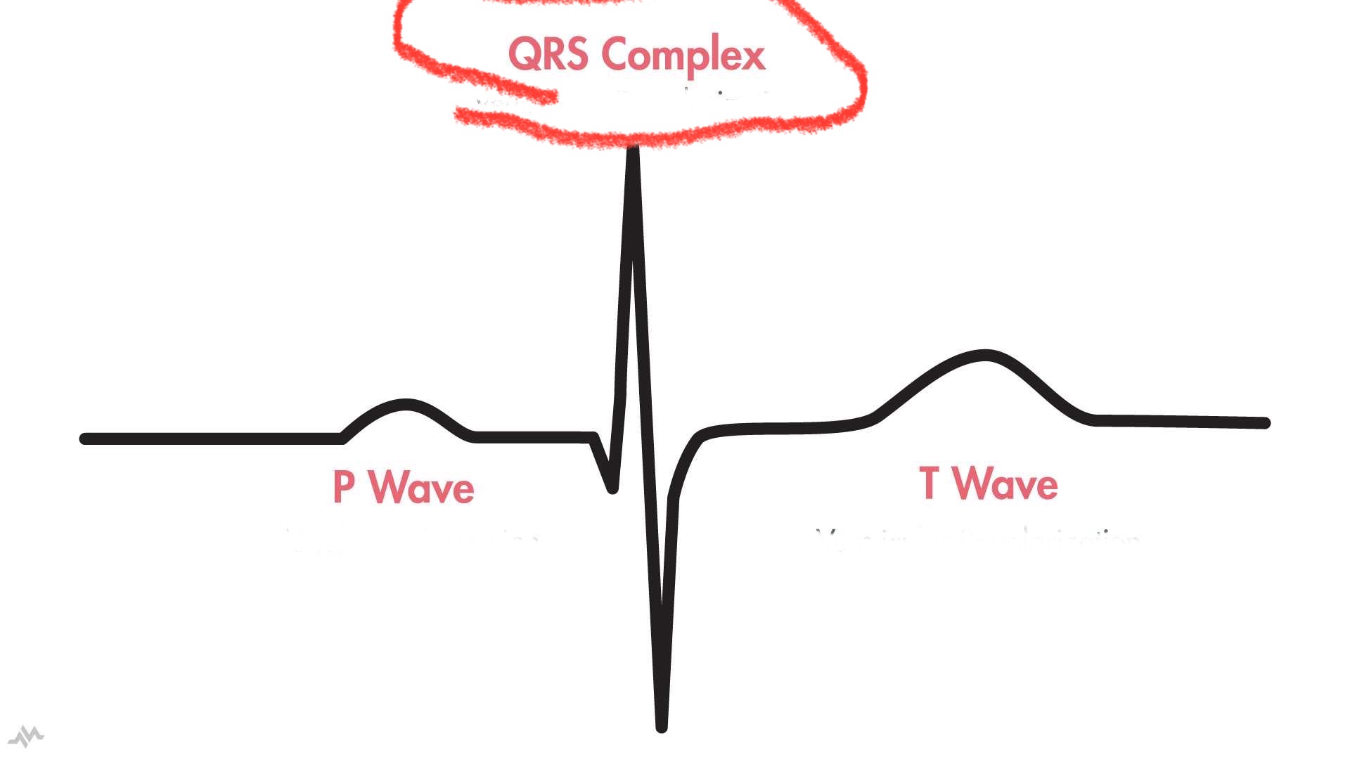 <p>what is the QRS complex</p>