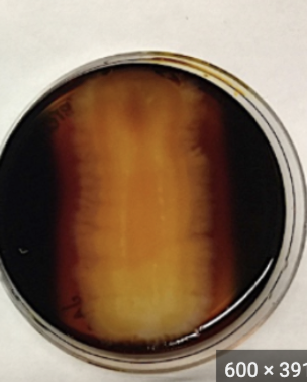 <p>What is this plate? and what does it say about the bacteria?</p>