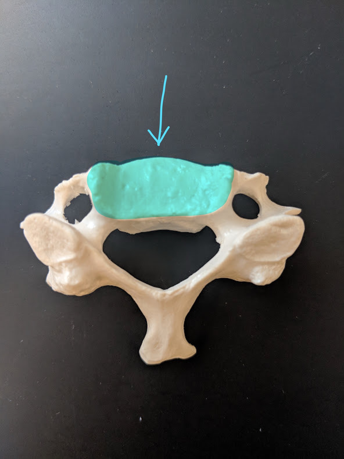 <p>Name this structure</p>