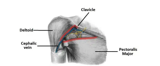 <ul><li><p>Inferiorly and laterally into the upper limb</p></li><li><p>Through the quadrangular space (branch of axillary artery)</p></li><li><p>Clavipectoral triangle (cephalic vein, medial + lateral pectoral nerves)$</p></li></ul><p></p>