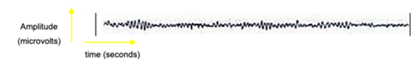 <p>What is the first stage of non-REM sleep?</p>
