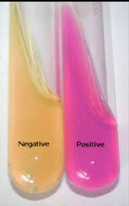 <p>Urease Test</p>
