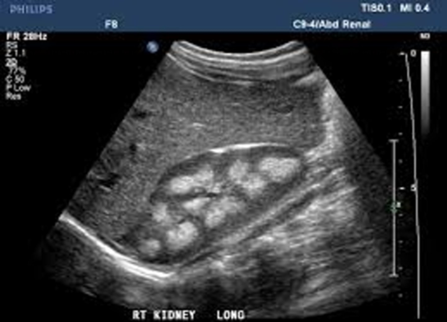 <p>MSK is ___ and has an unknown ___ </p>