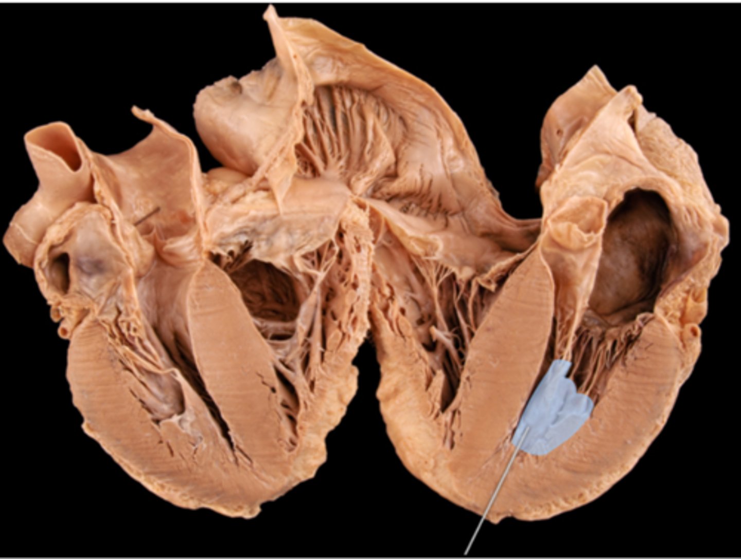 <p>papillary muscles</p>