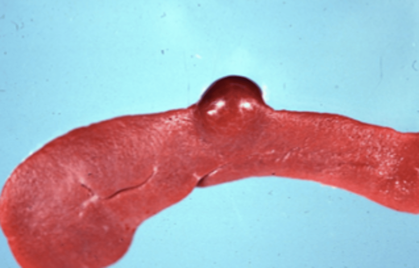 <p>What type of cellular adaptation is shown in this photo?</p>