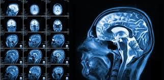 <p>MRI (Magnetic Resonance Imaging)&nbsp;</p>