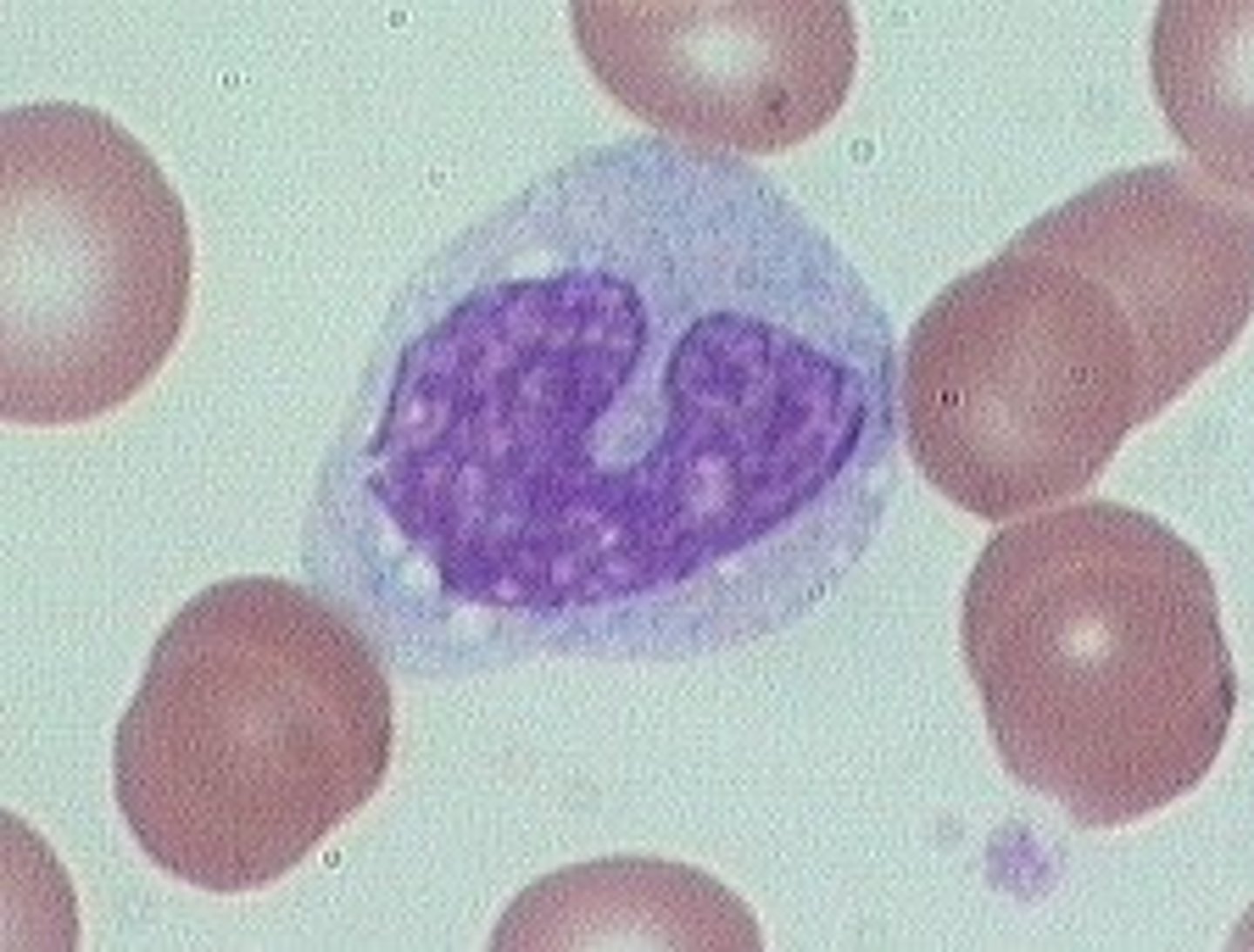 <p>- Has a nuclei</p><p>- no hemoglobin</p><p>- WBC are larger then RBC</p><p>- 5,000-10,000mm³</p>