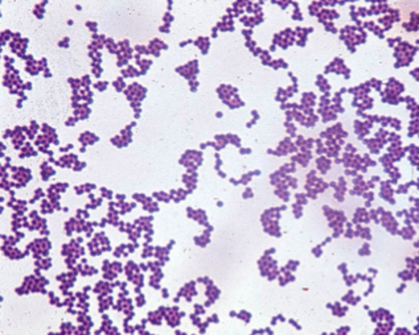 <p>Staph aureus is present in about ___% of the population on the skin/nares. MRSA is in ____ of the general population.</p>