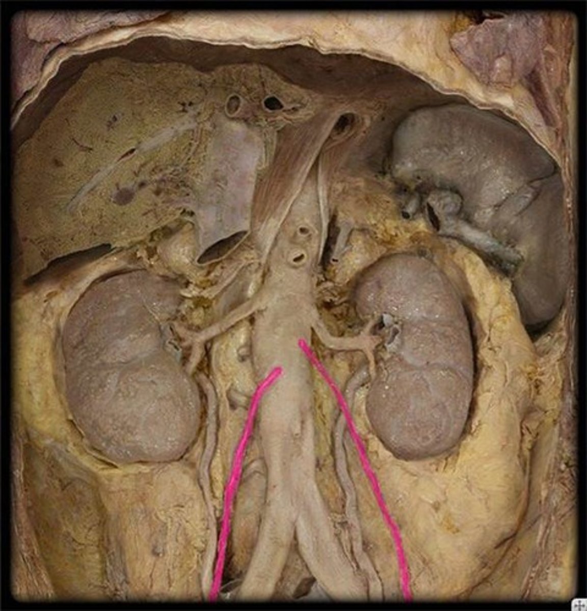 <p>Name these vessels.</p>