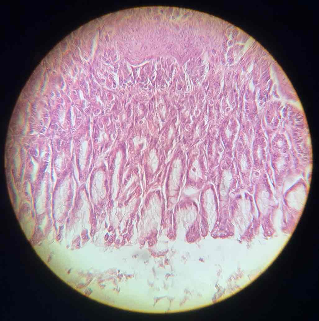 term image